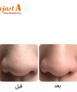 ماسک بینی سه مرحله ای ضدجوش سرسیاه بیوآکوا مدل STEP 3